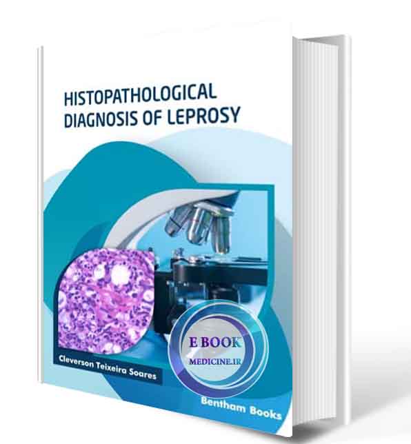 دانلود کتاب Histopathological Diagnosis Of Lepros 2021 (ORIGINAL PDF)